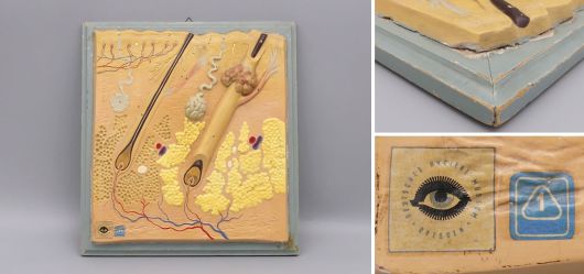 Antikes Gipsmodell der menschlichen Haut Deutsches Hygiene-Museum Dresden um 1940